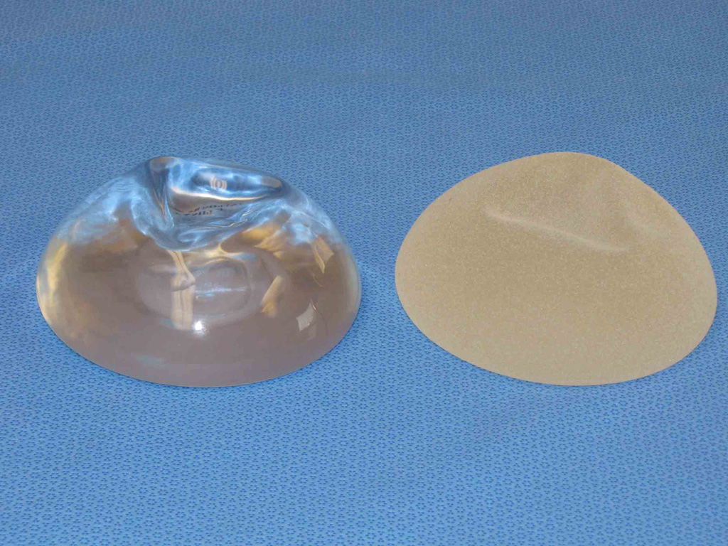 Silicone Breast Implant Photos 76