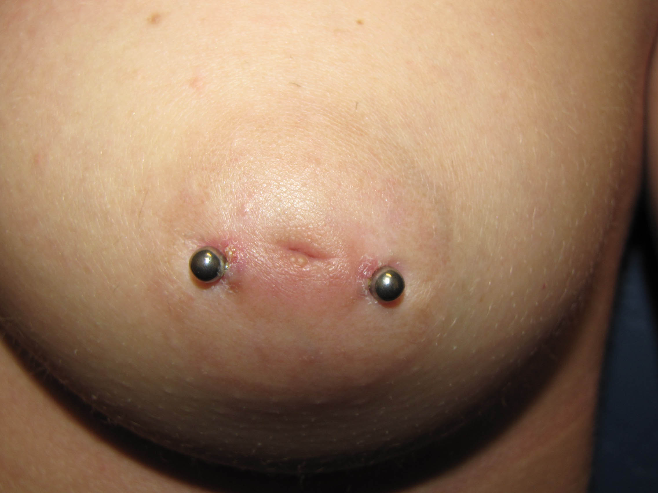 Nipples Peirced 103