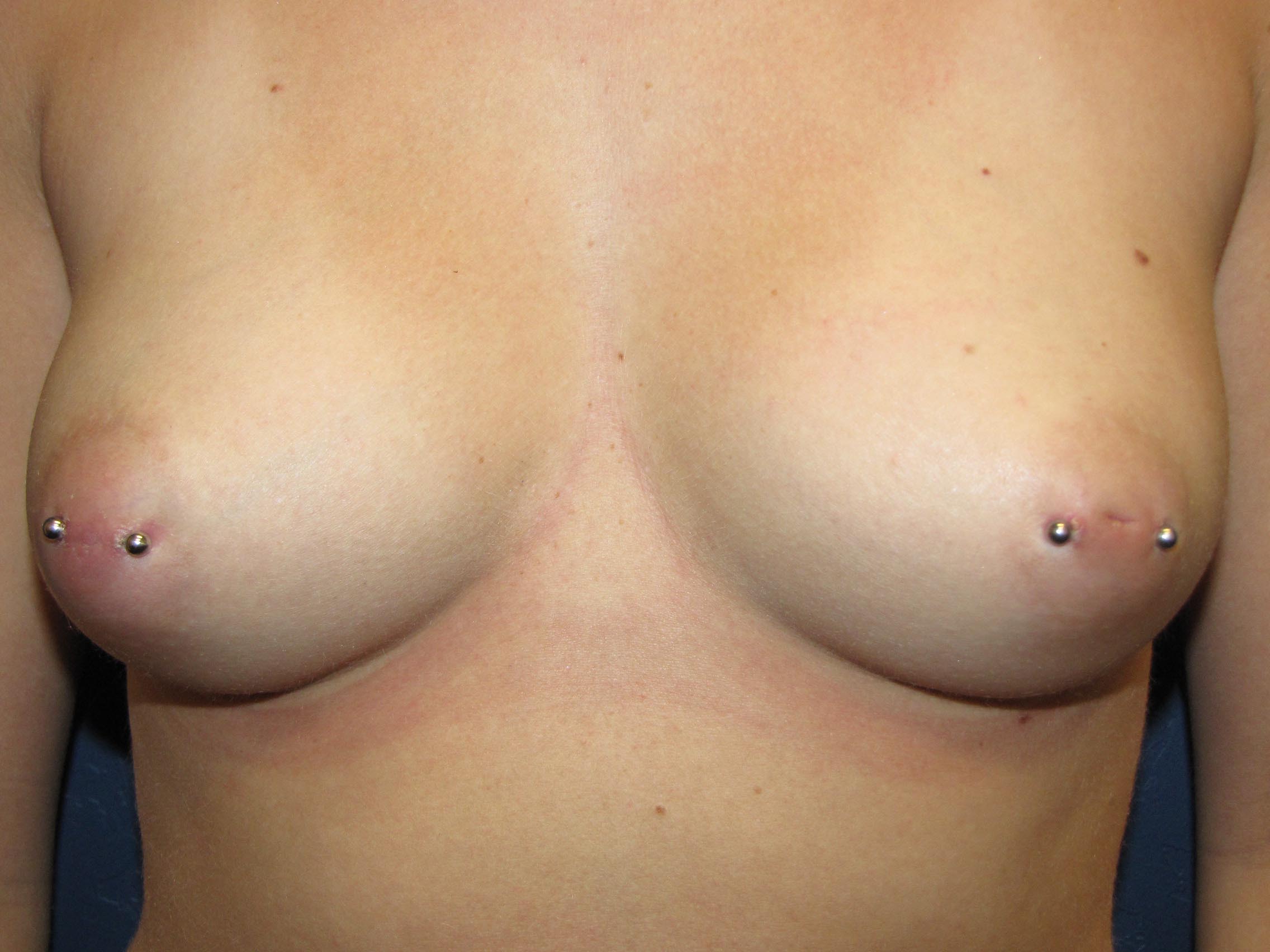 Inverted Nipples Pierced 56