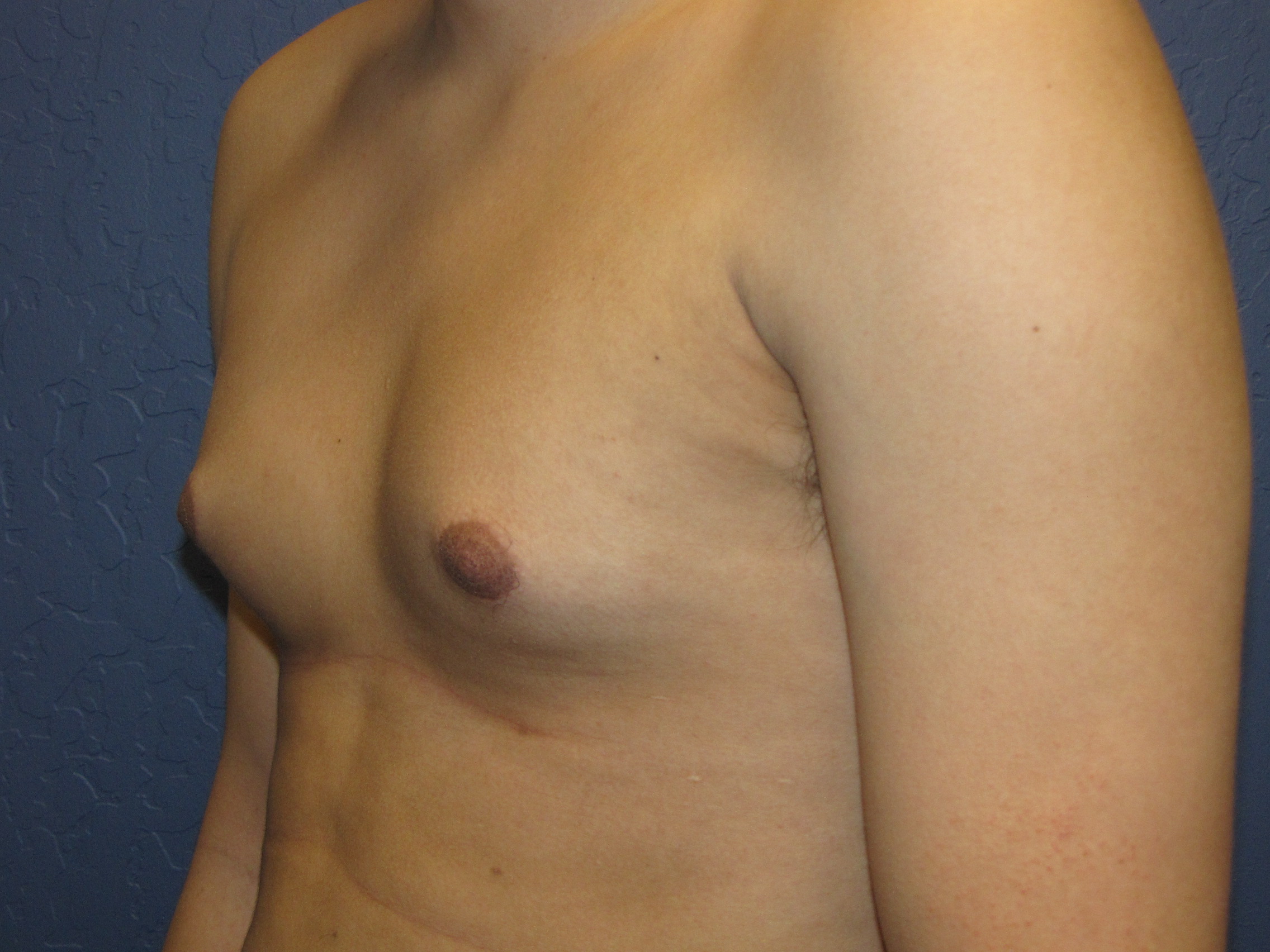 Oops Teen Budding Breasts picture Oops Teen Budding Breasts