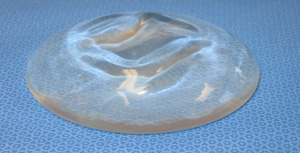 Smooth (left) and Textured (right) Silicone Implants