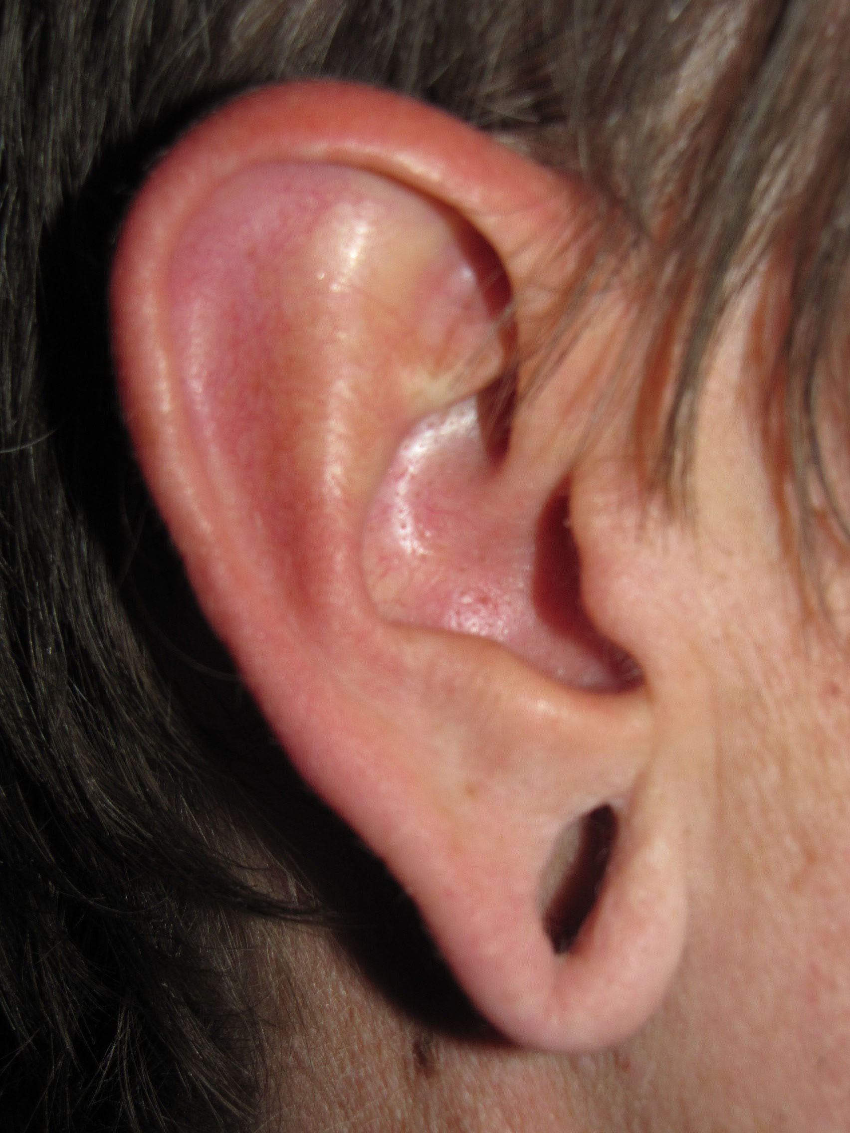 Ear lobe gauge deals