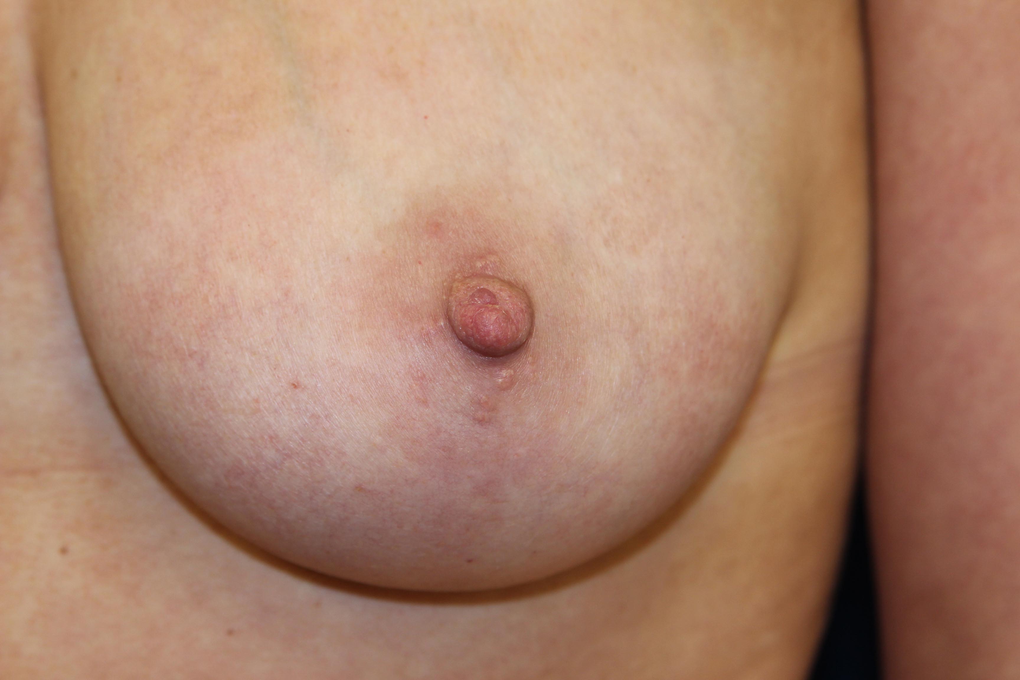Celeberty nipple