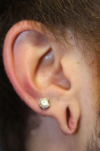 C) Right gauged earlobe