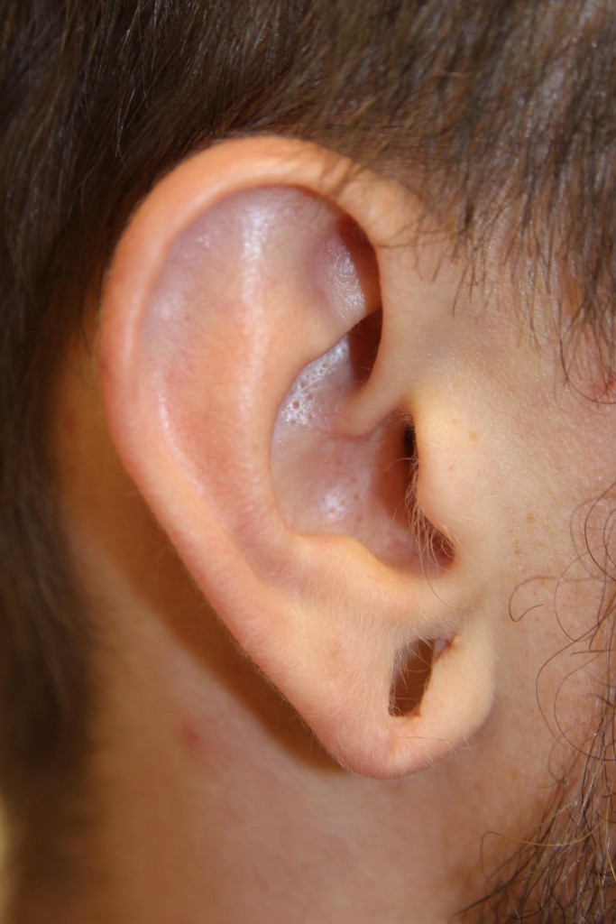 1.) Gauged right earlobe 