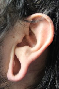 A. Gauged left earlobe