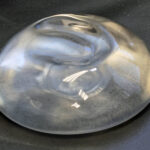 Breast Explantation: Understanding the Removal of Breast Implants and Why More Women Are Choosing It